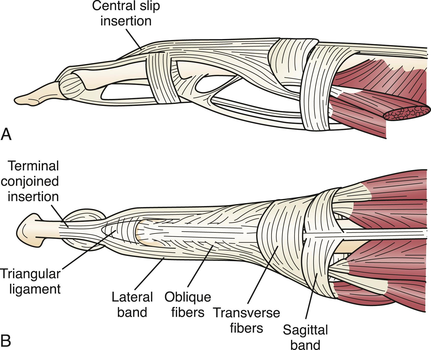 Fig. 70.4, Extensor mechanism of the fingers. (A) Lateral view. (B) Dorsal view.