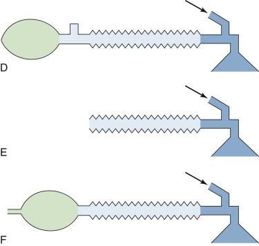 Fig. 23.12, Mapleson D, E (Ayre’s T-piece) and F (Jackson-Rees modification of Ayre’s T-piece) rebreathing systems.