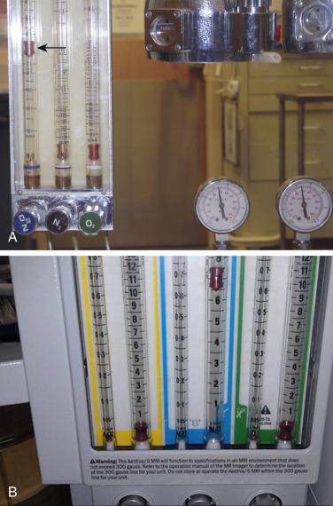 Fig. 23.2, (A) Limitations of the “fail-safe” system (pressure sensor shutoff valve/oxygen failure protection device). The “fail-safe” system is pressure sensitive but not flow sensitive. Because the supply pressure of oxygen is adequate, nitrous oxide may flow to its flowmeter and beyond at 4 L/min even though the oxygen flow control valve is turned off and there is no flow of oxygen. (B) Seemingly the same as panel A, but in this case, the problem was a failure of the Link-25 nitrous oxide-oxygen proportioning system.