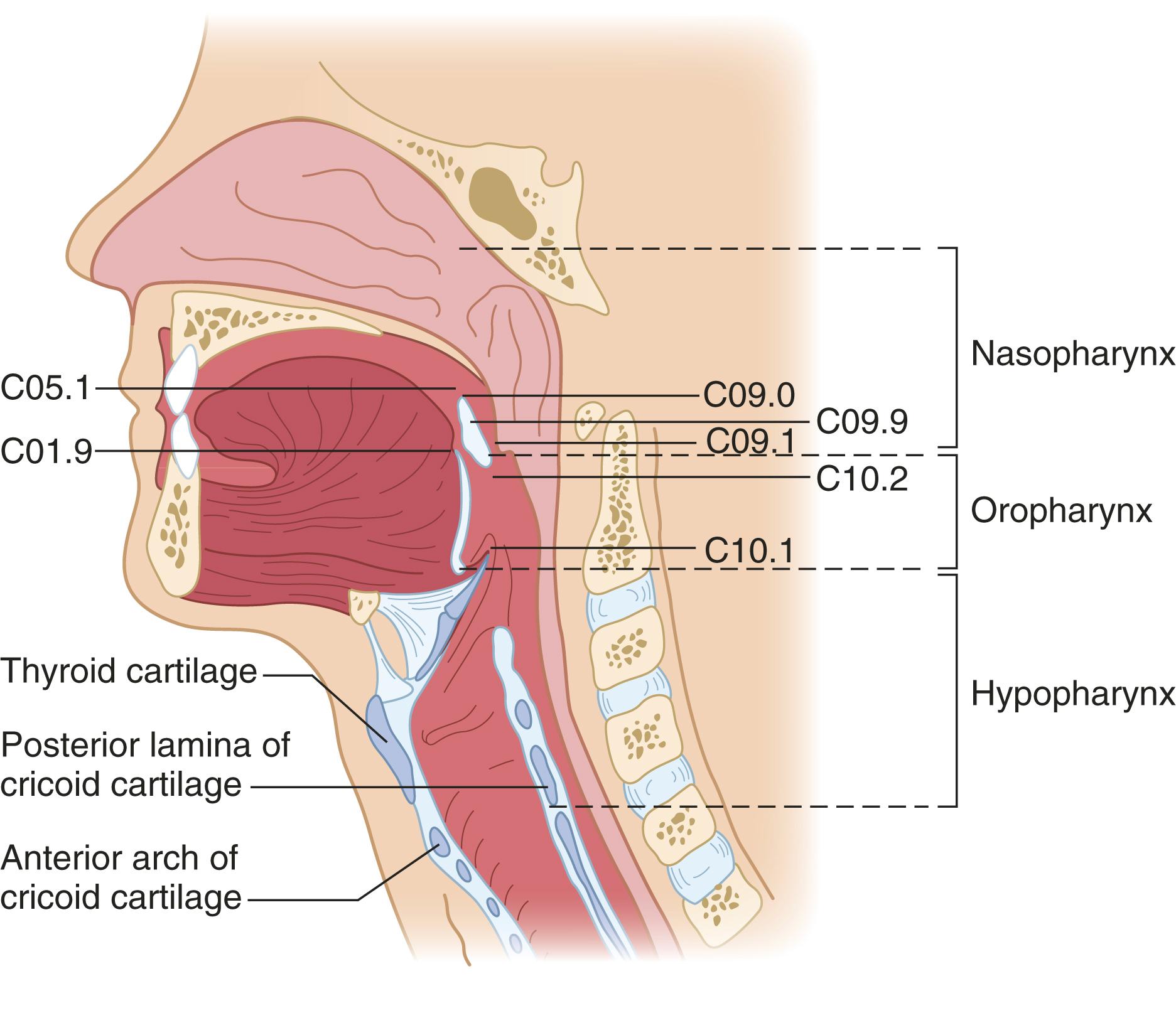 FIGURE 176-1, More than 95% of head and neck cancers arise from the mucosal surfaces of the upper aerodigestive tract.