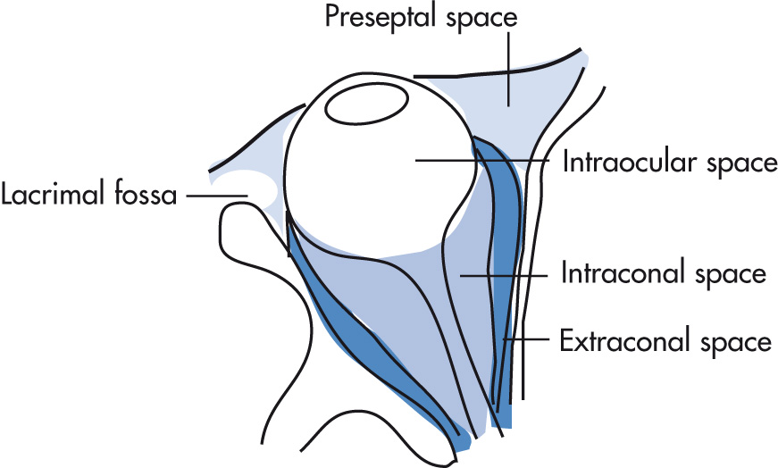 FIG. 7.11