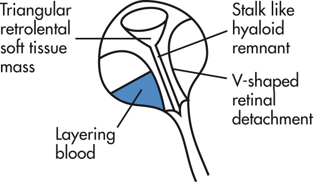 FIG. 7.15