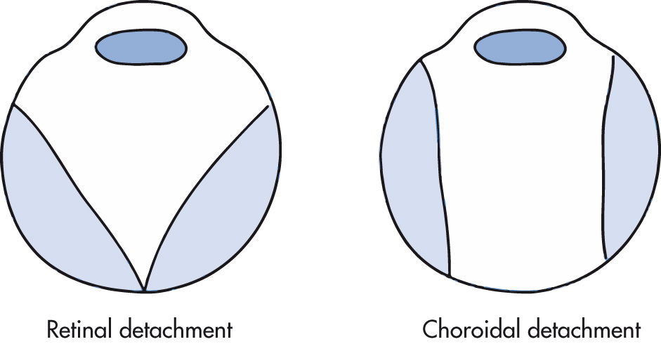 FIG. 7.17