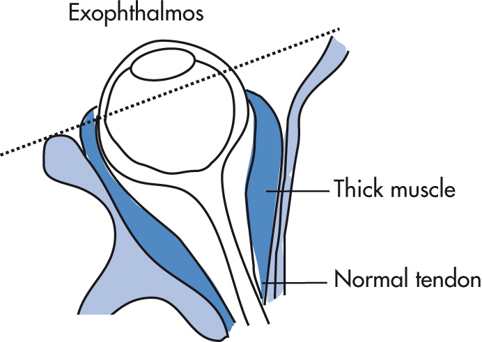 FIG. 7.19