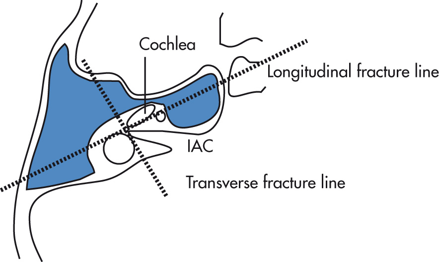 FIG. 7.7