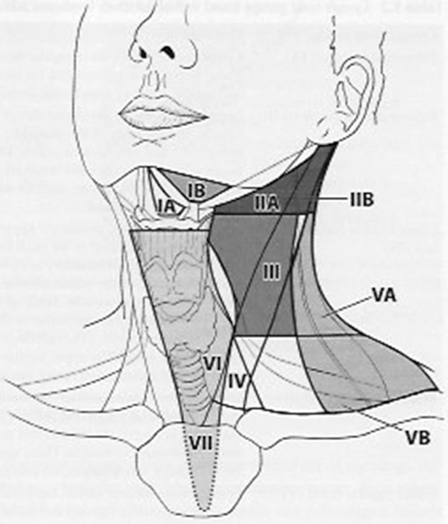 Figure 20.1, Lymph node dissection. From the AJCC Staging Manual, eighth edition 2017, page 70.Lymph node groups should be separated and reported using standard terminology as follows:Level I: Submental and submandibular lymph nodesIA: SubmentalIB: SubmandibularLevel II: Upper jugular lymph nodesIIA: Anterior (medial) to the vertical plane defined by the spinal accessory nerveIIB: Posterior lateral to the vertical plane defined by the spinal accessory nerveLevel III: Middle jugular lymph nodesLevel IV: Lower jugular lymph nodes including the Virchow nodeLevel V: Posterior triangle lymph nodesVA: Spinal accessory lymph nodesVB: Lransverse cervical lymph nodes and supraclavicular nodes, with the exception of the Virchow nodeLevel VI: Anterior compartment lymph nodes (pretracheal and paratracheal lymph nodes, precricoid (Delphian) lymph node, and the perithyroidal nodes, including the lymph nodes along the recurrent laryngeal nerveLevel VII: Superior mediastinal (pretracheal, paratracheal, and esophageal groove lymph nodes)