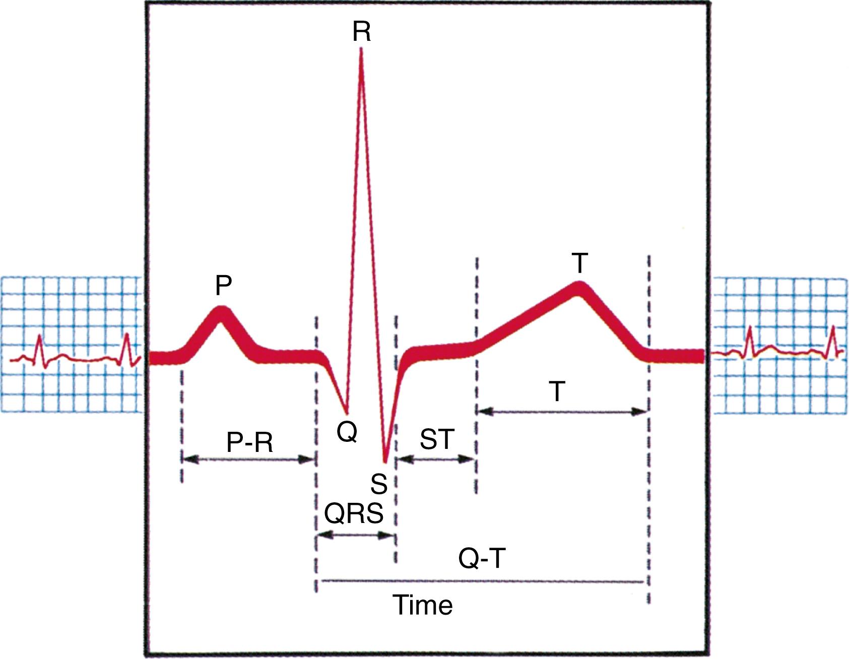 FIG. 15.9, Usual electrocardiogram waveform.