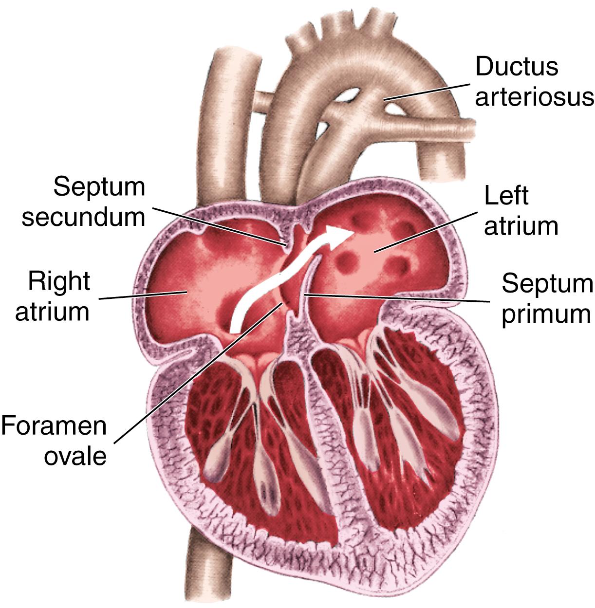 FIG. 15.10, Anatomy of the fetal heart.