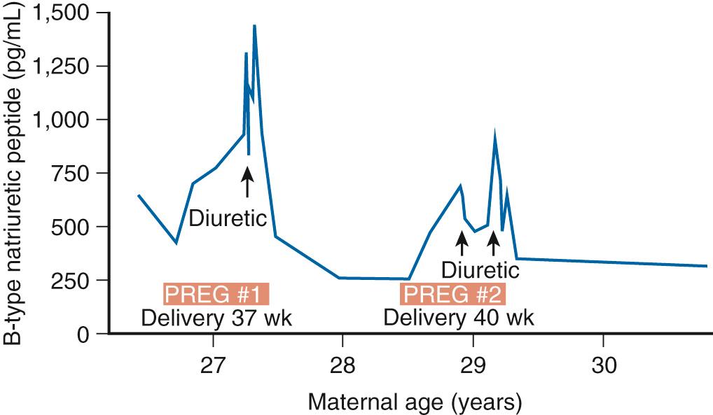 Fig. 42.4, Changes in β-Natriuretic Peptide in a Patient Across Two Pregnancies.