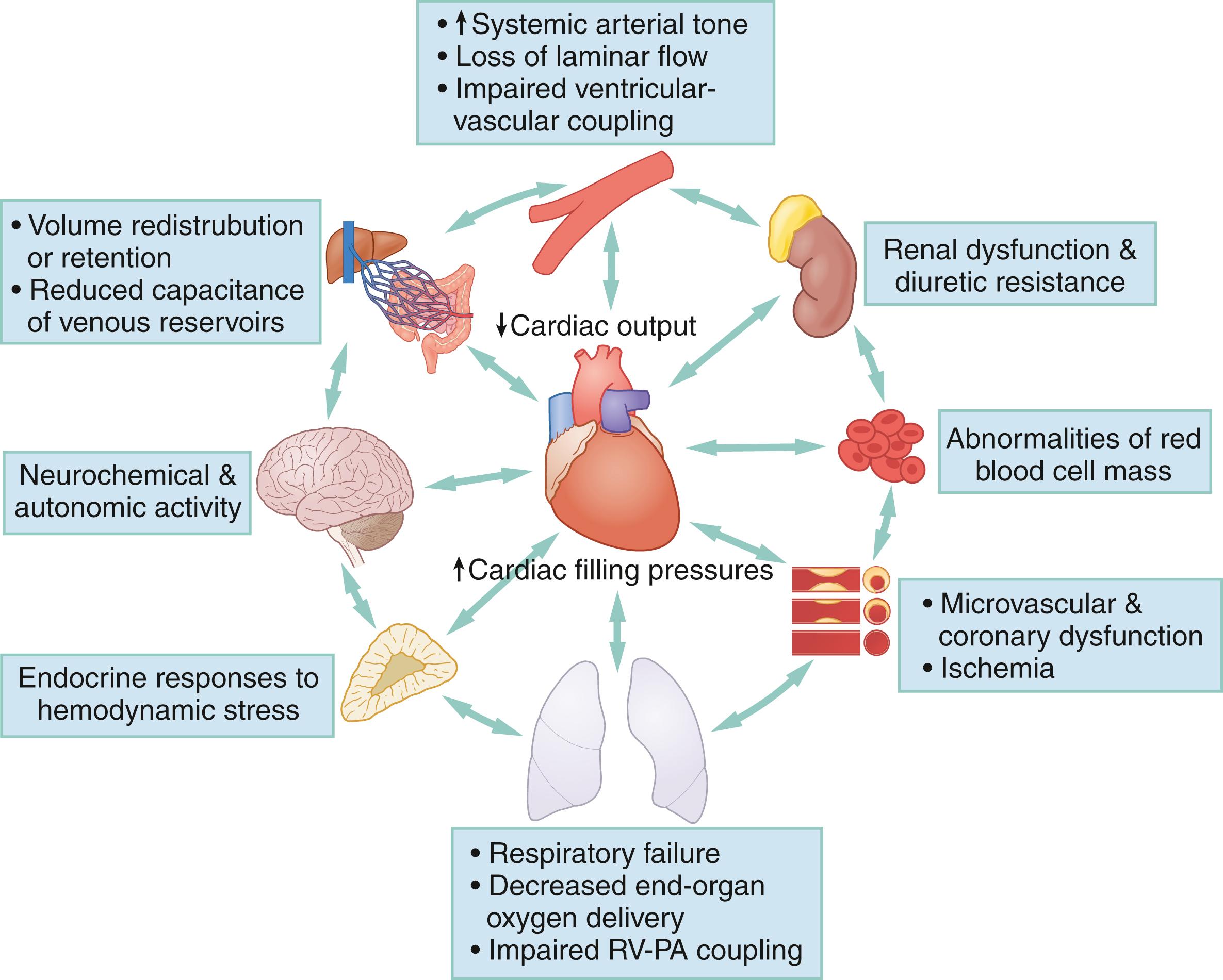 Fig. 67.3, A multiorgan, multidirectional concept chart of AHF. Increased intracardiac pressures or reduced CO (ie, a sine qua non of AHF) can be the result or the cause of other organ system dysfunction. Activation of the sympathetic and RAAS neurohomonal axes, for instance, can be a precipitant of AHF. However, depressed CO also will activate these neurohormonal mechanisms both directly and indirectly. Certain bidirectional relationships have been described as distinct and important syndromes, such as the cardiorenal syndrome. Not every cardiac to end-organ relationship pictured here is a key component of every AHF presentation, underlining the importance of AHF phenotypic heterogeneity and the fact that therapeutic approaches should be tailored to phenotype when possible. Also, many relationships not pictured are likely important in some cases since understanding of AHF physiology is continuously changing. AHF , acute heart failure; CO , cardiac output; RAAS , renin-angiotensin aldosterone system; RV , right ventricle; PA , pulmonary artery.