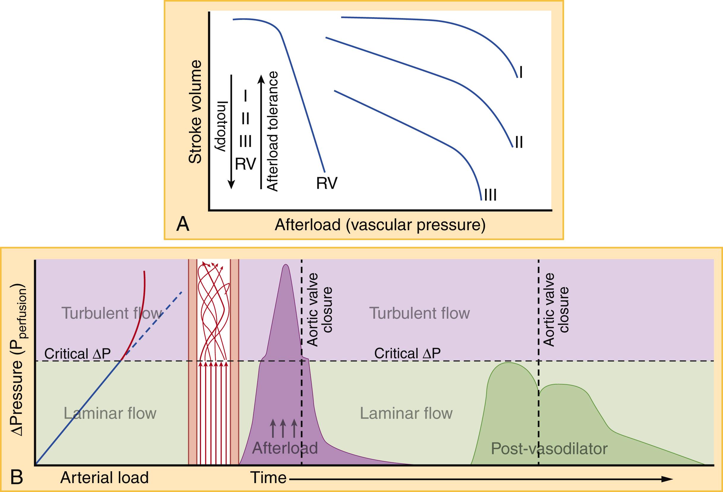 Fig. 67.6, (A) SV versus afterload relationship plotted for 3 levels of decreasing LV function (I–III) and the RV. Increasing afterload for a fixed degree of inotropic and lusitropic function causes a decline in stroke volume. However, resistance to this decline (a flatter slope) is higher with better baseline cardiac pump function. Eventually, regardless of ventricular resilience to afterload, vascular pressure can become high enough to induce a precipitous decline in stroke volume (ie, rapid ventricular-vascular decoupling). The RV is extremely pressure sensitive (but more volume tolerant) compared to the LV. (B) The relationship between the ventricular-vascular pressure difference (“driving pressure” or “delta pressure”) and arterial flow rate ( right ) or time ( left ) for a set afterload. In order to overcome high afterload, cardiac driving pressure must increase to maintain arterial flow. This relationship is linear when flow is laminar, but flow becomes turbulent once the pressure difference reaches or exceeds a critical value. Under turbulent flow, further increases in the pressure difference yield decreasing rates of return in arterial flow despite steadily increasing cardiac MVO 2 . Flow thus becomes highly inefficient as ventricular-vascular decoupling progresses (eg, in severe hypertension), as in the purple curve of the delta pressure versus time. When blood pressure is lowered (post-vasodilator green curve ), a larger proportion of flow is laminar and the driving ventricular-vascular pressure difference is spread more evenly over time, leading to more efficient hemodynamics (ie, lower MVO 2 required to produce similar degree of flow). In AHF the “supply” of myocardial oxygen is lowered while the “demand” is increased, so decreasing MVO 2 for a given SV is physiologically beneficial. In the initial resuscitation of the hypertensive/vascular AHF phenotype this typically means IV bolus vasodilators such as nitroglycerin. SV , stroke volume; LV , left ventricle; RV , right ventricle; MVO 2 , myocardial oxygen consumption rate.