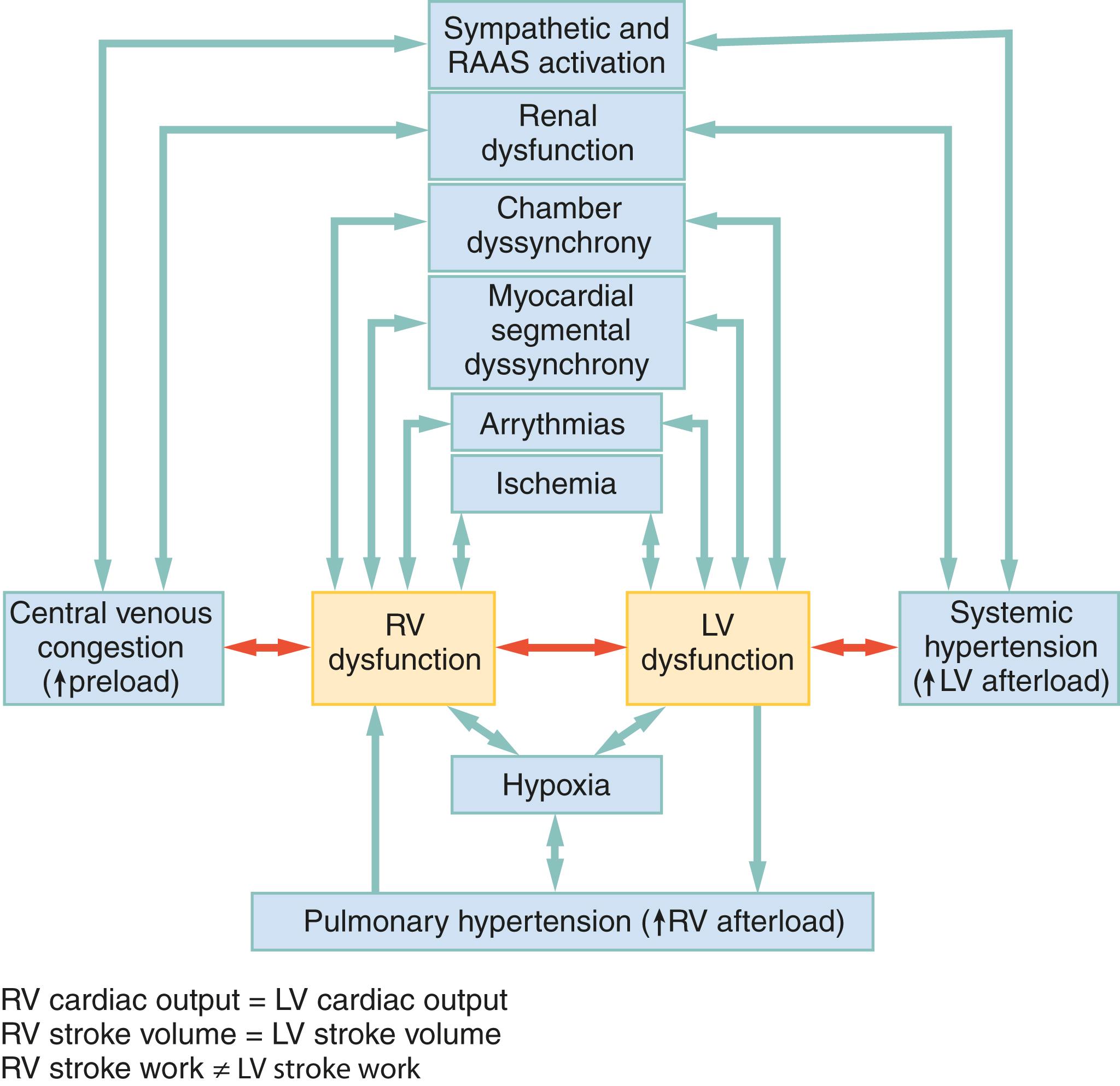 Fig. 67.8, A physiologic flow diagram of the biventricular nature of AHF. Although LVD has long been the focus of an understanding of AHF, it is now recognized that RVD is common, indicates severity of presentation, and predicts poor prognosis. Because both ventricles share (on average, beat to beat) a CO and a wall (ie, the intraventricular septum), forces affecting the RV affect the LV (and vice versa). RV and LV stroke work, however, is not inherently equal and it has been shown that improvement of the former in response to AHF treatment is associated with better outcomes than improvement in the latter. Disorganization of contraction, ischemia, volume overload, acute ventricular-vascular decoupling, or other insults in one ventricle are transmitted to the other ventricle through complex and somewhat unpredictable ways. LVD causing PHTN and subsequent RVD (the classic understanding of “right heart failure”) is only one of many ways that RVD develops in AHF (ie, PHTN is neither necessary nor sufficient to produce acute RVD in AHF patients). AHF , acute heart failure; LV , left ventricle dysfunction; RVD , right ventricle; LVD/RVD , LV/RV dysfunction; CO , cardiac output; RAAS , renin-angiotensin-aldosterone-system; PHTN , pulmonary hypertension.