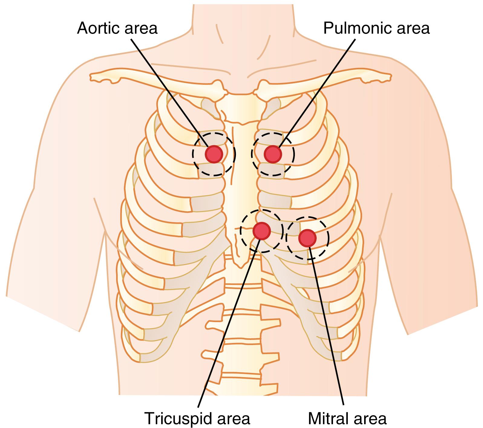 Figure 23-2, Chest areas from which sounds from each valve are heard best.