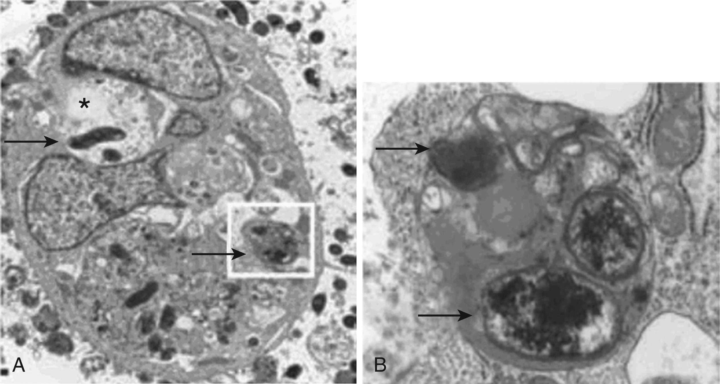 Fig. 27.2, Helicobacter pylori Induces Autophagy.