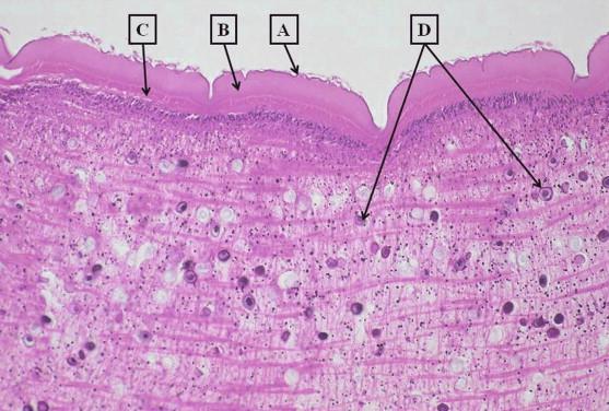FIGURE 27-1, Body wall and parenchyma of Taenia species proglottid. Note (A) microvillar layer, (B) thick tegument, (C) two layers of smooth muscle, and (D) calcareous corpuscles.