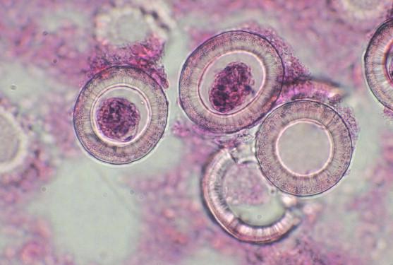 FIGURE 27-2, Taenia species eggs from ruptured proglottid in appendix.