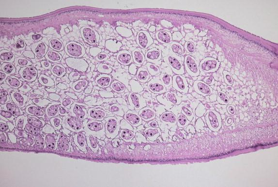 FIGURE 27-3, Dipylidium caninum gravid proglottid passed in feces of child showing eggs in packets.