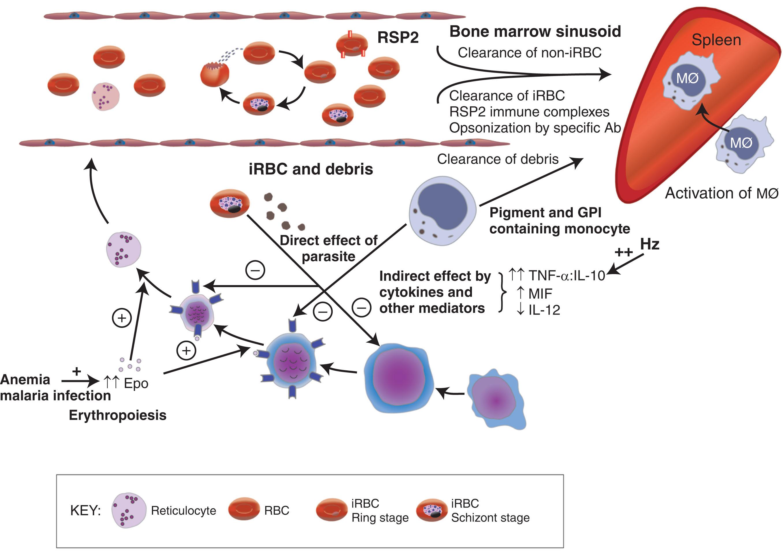 Figure 154.3, PATHOGENESIS OF MALARIAL ANEMIA.