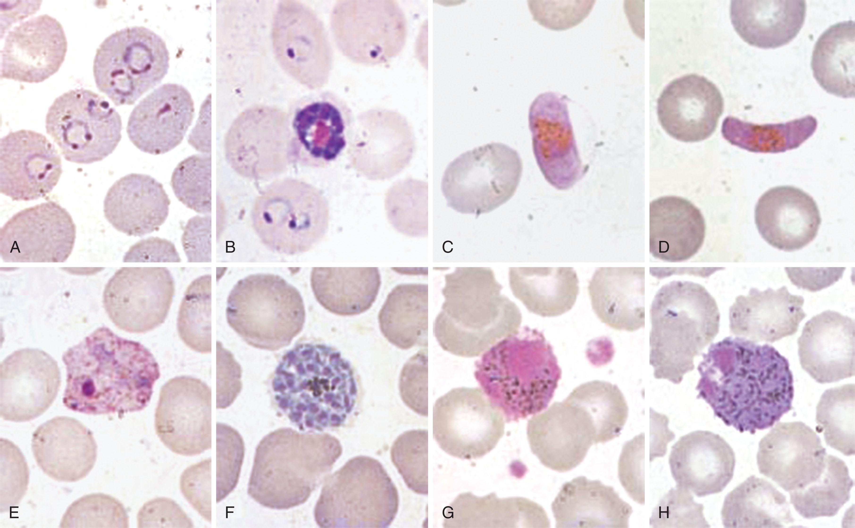 Figure 154.5, BLOOD-STAGE MALARIA (THIN BLOOD FILMS).