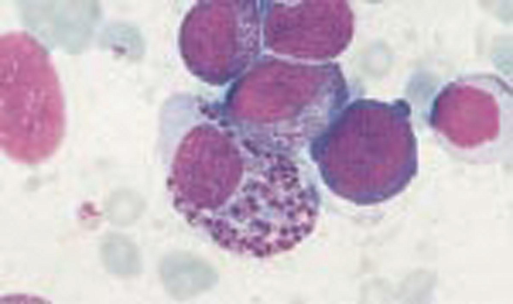 Figure 154.8, LEISHMANIA INFANTUM IN MACROPHAGE FROM BONE MARROW.