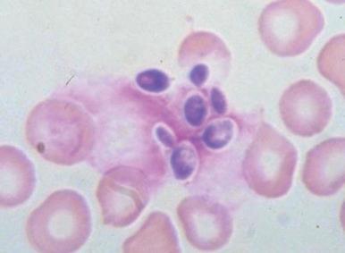 Figure 37-4, Candida albicans.