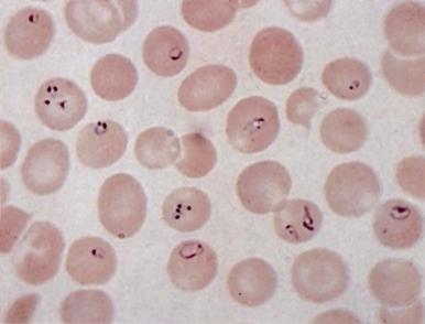 Figure 37-7, Babesiosis in the peripheral red blood cells.