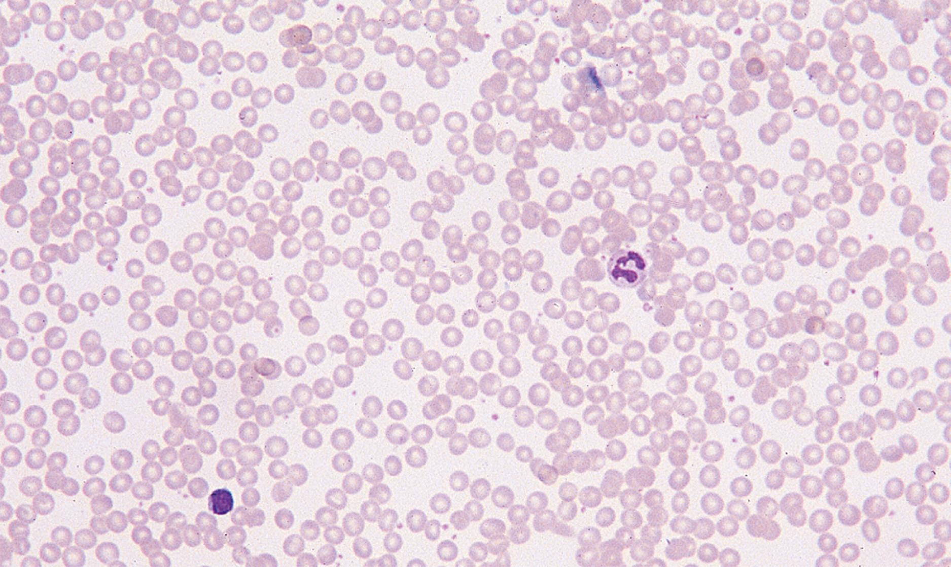 Fig. 12.1, Peripheral blood smear. The appearance of a normal peripheral blood smear when viewed under low magnification (×100).