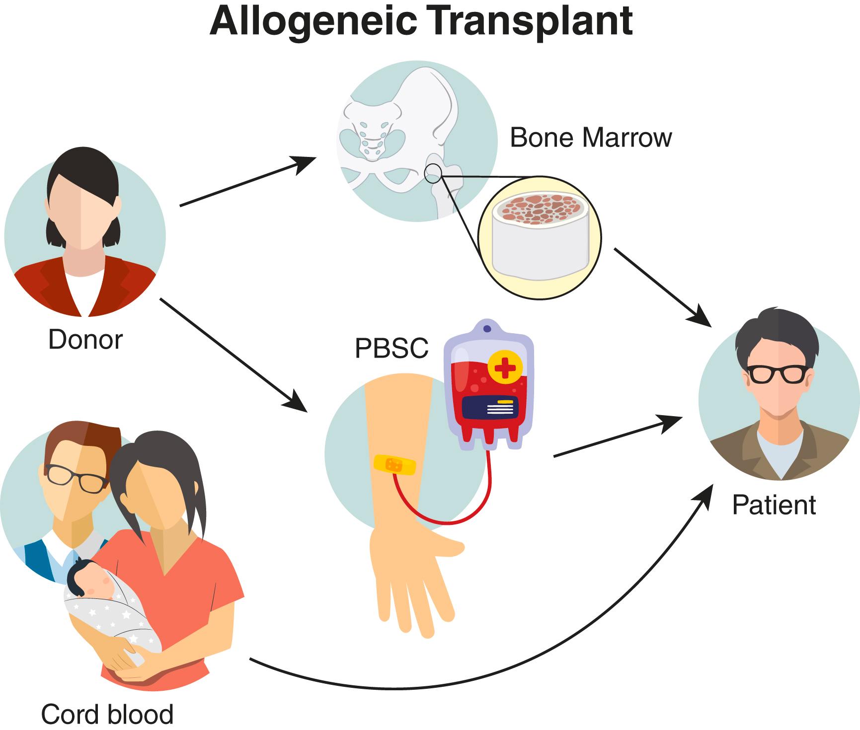 FIGURE 163-1, The process of allogeneic hematopoietic cell transplantation.