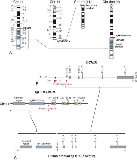 FIGURE 12-19, Translocation t(11; 14)(q13;q32).