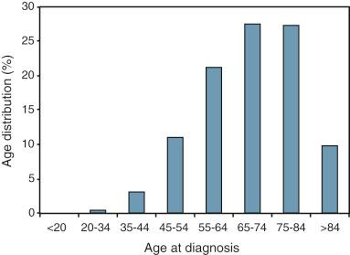 FIGURE 12-3, Age distribution of multiple myeloma cases.