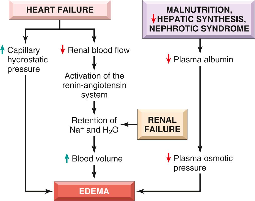 Figure 4.2, Mechanisms of systemic edema in heart failure, renal failure, malnutrition, hepatic failure, and nephrotic syndrome.