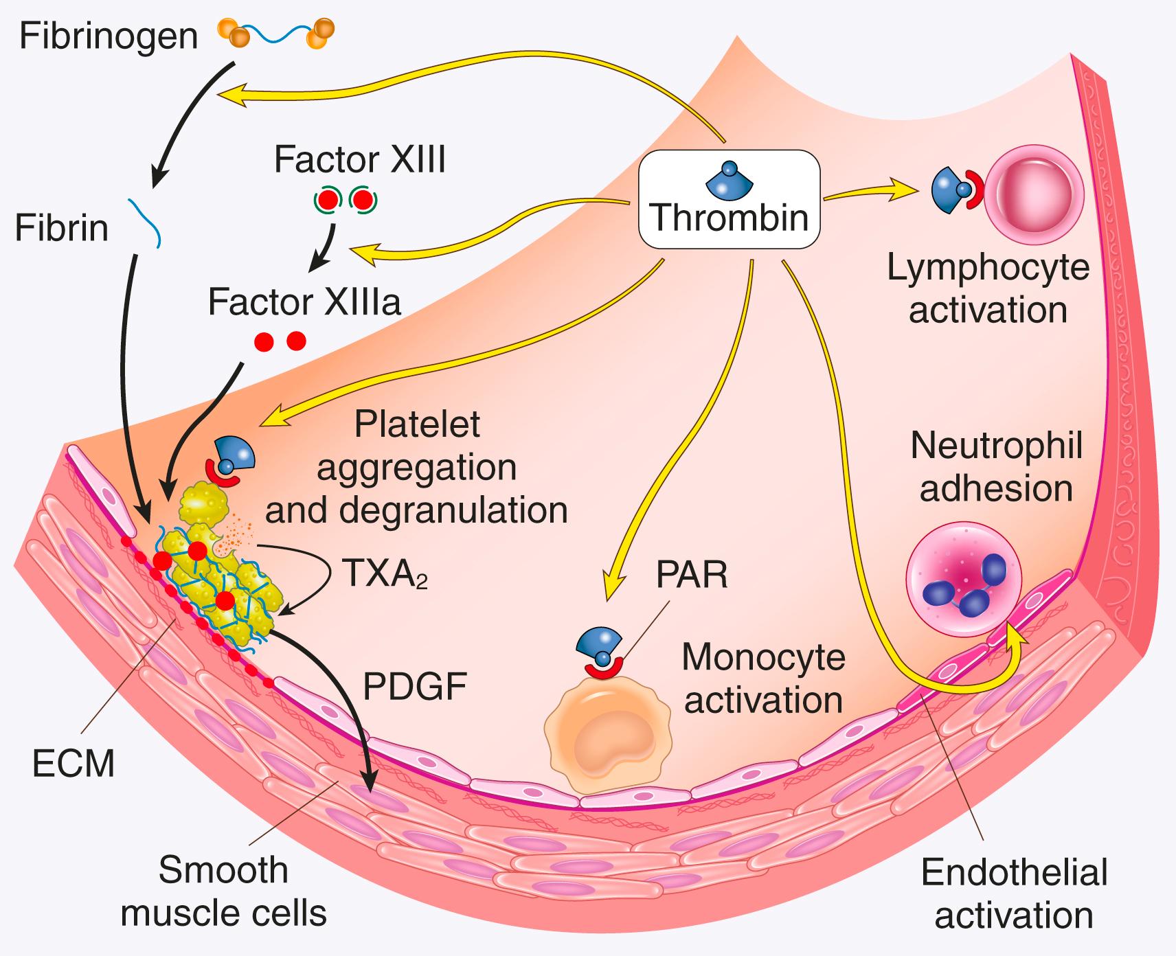 FIG. 3.9, Role of thrombin in hemostasis and cellular activation. During clotting, thrombin cleaves fibrinogen and activates factor XIII. In addition, through protease-activated receptors (PARs), thrombin activates (1) TxA 2 secretion, platelet aggregation, and platelet degranulation; (2) endothelium, which responds by generating leukocyte adhesion molecules; and (3) leukocytes, increasing their adhesion to activated endothelium. ECM, Extracellular matrix; PDGF , platelet-derived growth factor; TxA 2 , thromboxane A 2 .