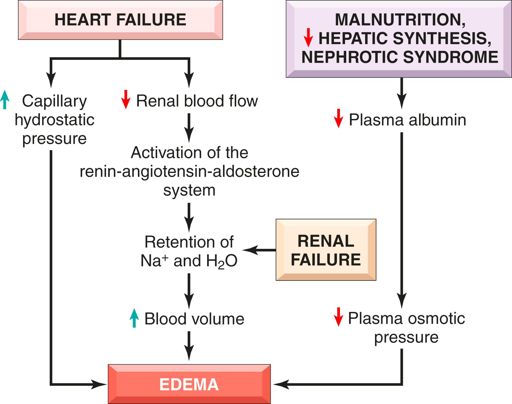 FIG. 3.3, Pathways leading to systemic edema resulting from heart failure, renal failure, or reduced plasma osmotic pressure, which has several causes including liver failure.