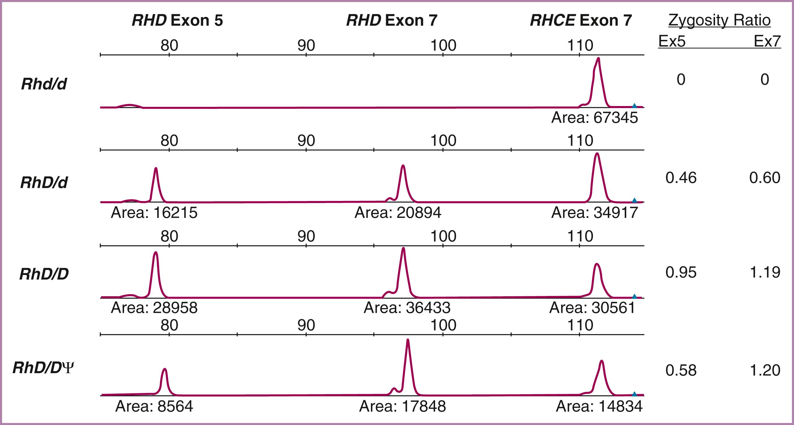 Figure 35.4, Paternal zygosity testing.