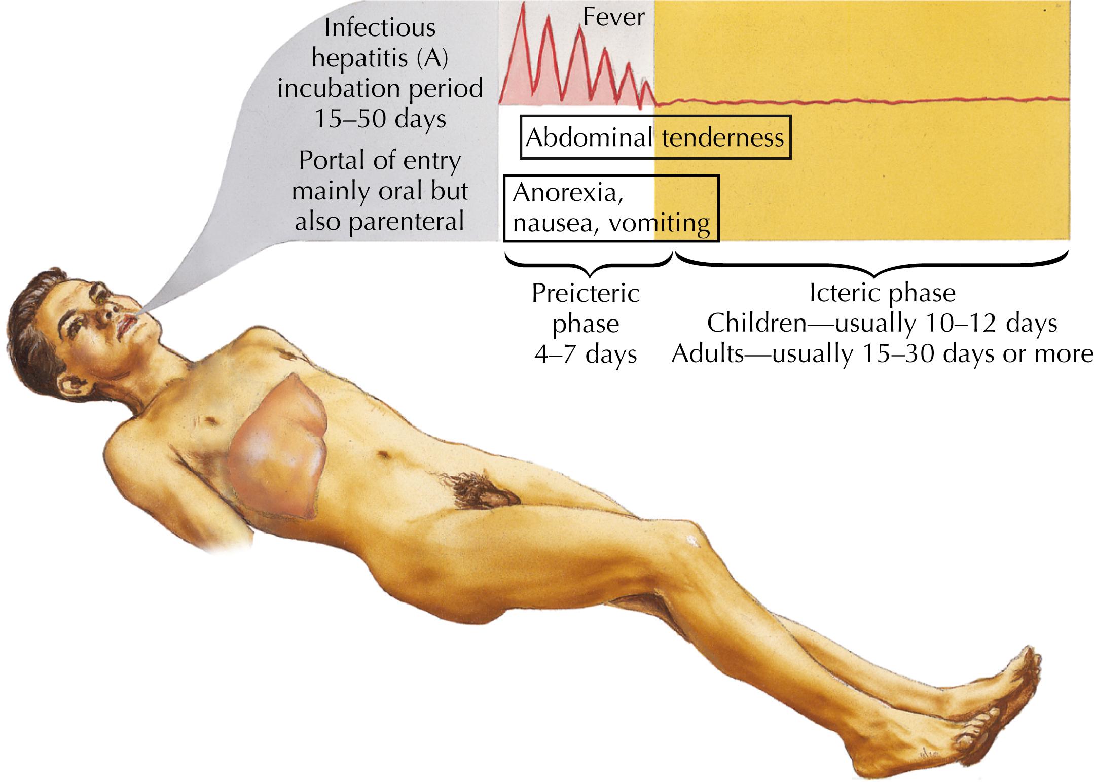 Fig. 14.4, Clinical course of hepatitis A.