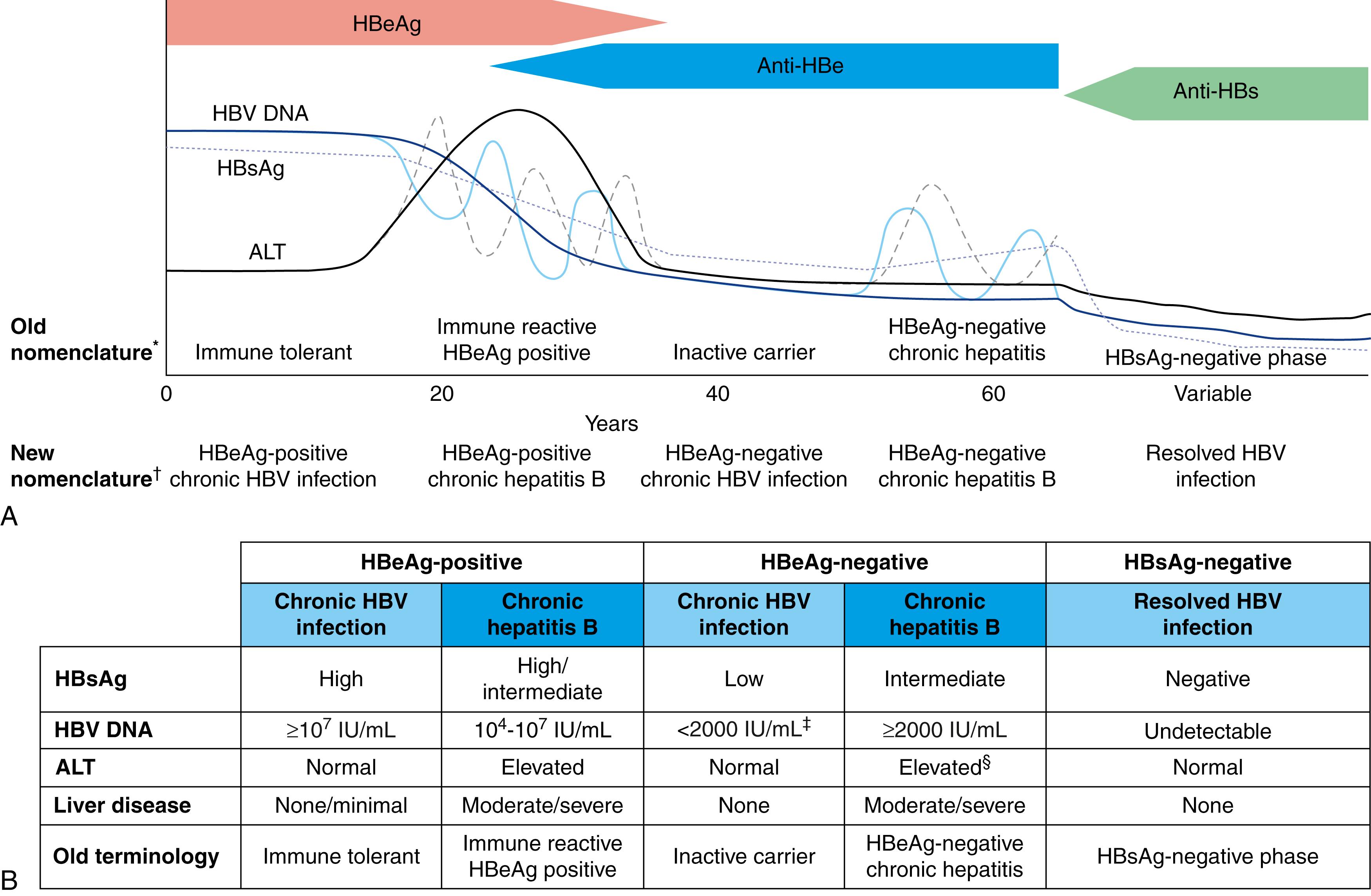 Fig. 79.4, Natural history of and new nomenclature for patients with chronic HBV infection. The course is shown graphically in A , and the criteria for each phase are shown in B . Particularly in patients who are infected early in life, the first phase is HBeAg-positive chronic HBV infection (previously known as the immune tolerant phase). After decades of normal serum ALT and high HBV DNA levels, this phase evolves to HBeAg-positive chronic hepatitis B (previously known as the immune reactive phase) of variable duration. In this phase, there is active viral replication (high serum HBVDNA levels) and inflammation (high serum ALT levels) and an indication for antiviral therapy. Ultimately, patients enter a spontaneous or therapeuticallyinduced phase of HBeAg-negative chronic HBV infection (previously known as the inactive carrier state), with minimal disease activity, which can last indefinitely. At the time of HBeAg seroconversion, however, immunologic pressure may select for a viral mutant (precore, core promoter, or both), which is incapable of producing HBeAg antigen. Viral and serum ALT levels typically fluctuate during this phase of HBeAg-negative chronic hepatitis B , and antiviral treatment is usually indicated. The last phase, which is the HBsAg-negative phase , (previously known as the HBsAg-negative phase) is characterized by negative HBsAg in serum and the presence of antibodies to HBcAg (anti-HBc), with or without detectable antibodies to HBsAg (anti-HBs). This phase is considered functional cure of HBV infection. If the patient has not entered this phase and is not treated, late disease complications often occur. The relative time dimensions of each phase are shown; note that there may be significant overlap of features among the various phases.