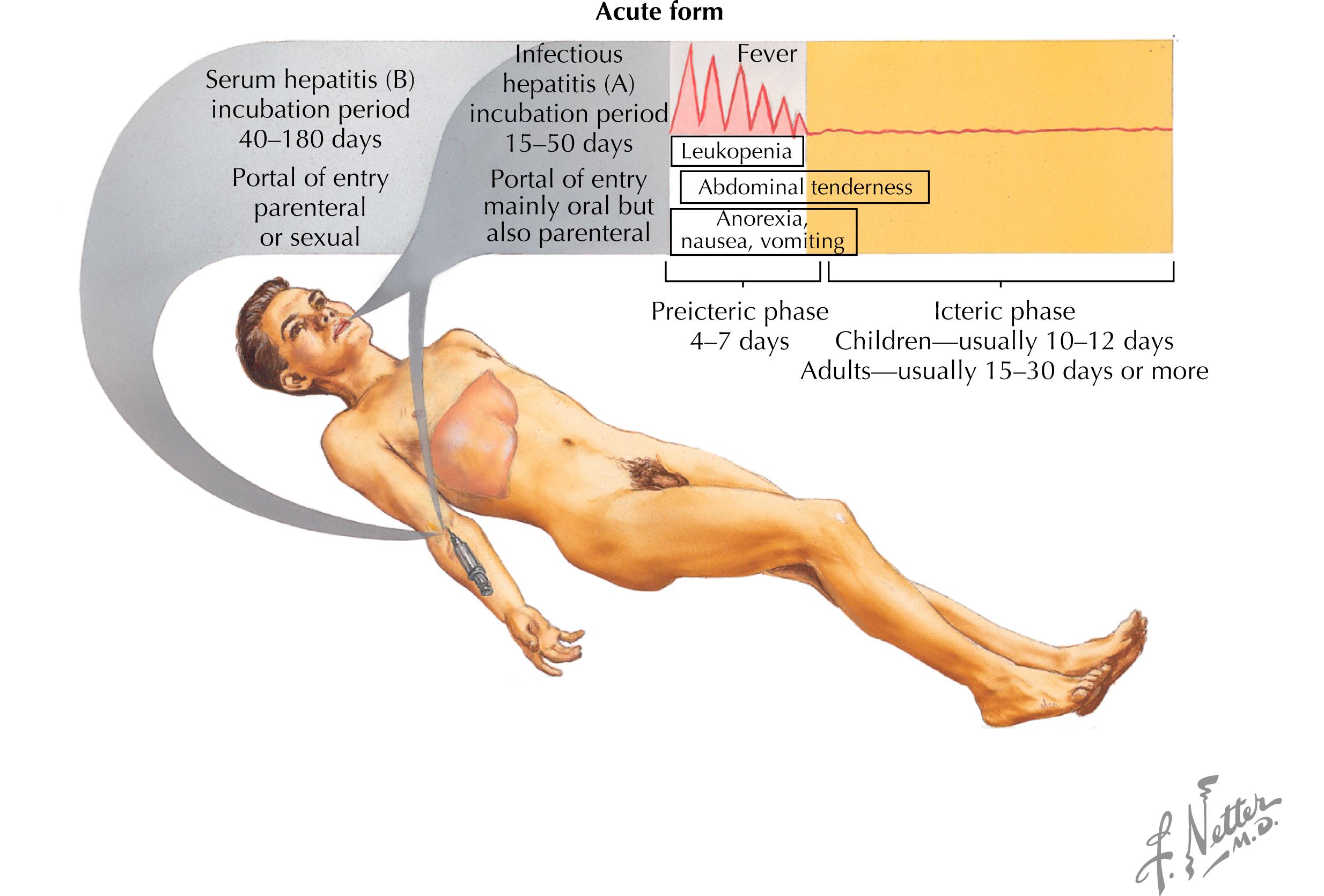 Fig. 15.1, Hepatitis B clinical presentation.