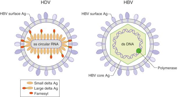 Fig. 34-2, Structural depiction of hepatitis B virus (HBV) and hepatitis delta virus (HDV). HDV utilizes the envelope proteins of HBV. HDV has a single-stranded circular RNA genome encoding one protein, delta antigen, that exists in two forms: small and large (which is modified by farnesyl). These elements are surrounded by a lipid envelope containing HBV surface antigen proteins taken from HBV. These HBV surface antigen proteins are the only component shared with HBV, as the latter has a completely different genome structure and internal virion composition.