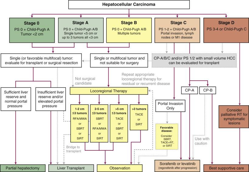 Fig. 56.2, Treatment algorithm for hepatocellular carcinoma (HCC) stratified by Barcelona Clinic Liver Cancer (BCLC) stage, including Child-Pugh (CP) class and performance status (PS). The algorithm is modified from the BCLC staging system and is intended to guide general treatment decisions. However, each case should be considered on its own based on tumor characteristics, liver function/reserve, PS, patient comorbidities, and available clinical trials. Evaluation at a multidisciplinary tumor board is always recommended. CP, Child-Pugh; M1, metastatic disease; MWA, microwave ablation; PEI, percutaneous ethanol injection; RFA, radiofrequency ablation; RT, radiotherapy; TACE, transarterial chemoembolization; SBRT, stereotactic body radiotherapy; SIRT, selective internal radiotherapy.