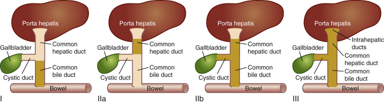 Figure 5.2, Kasai classification of biliary atresia.