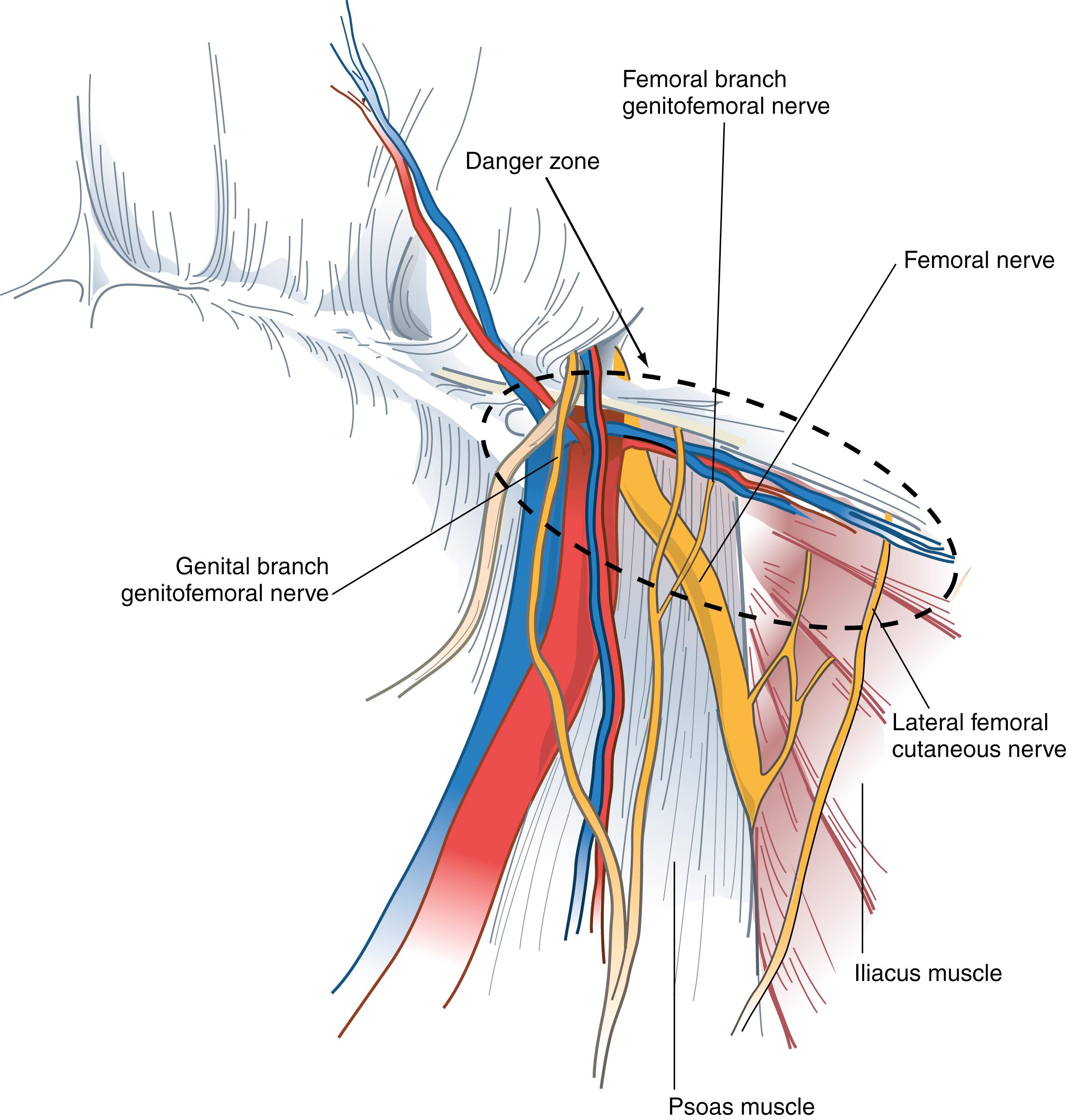 Fig. 45.4, Important nerves and their relationship to inguinal structures (the right side is illustrated).