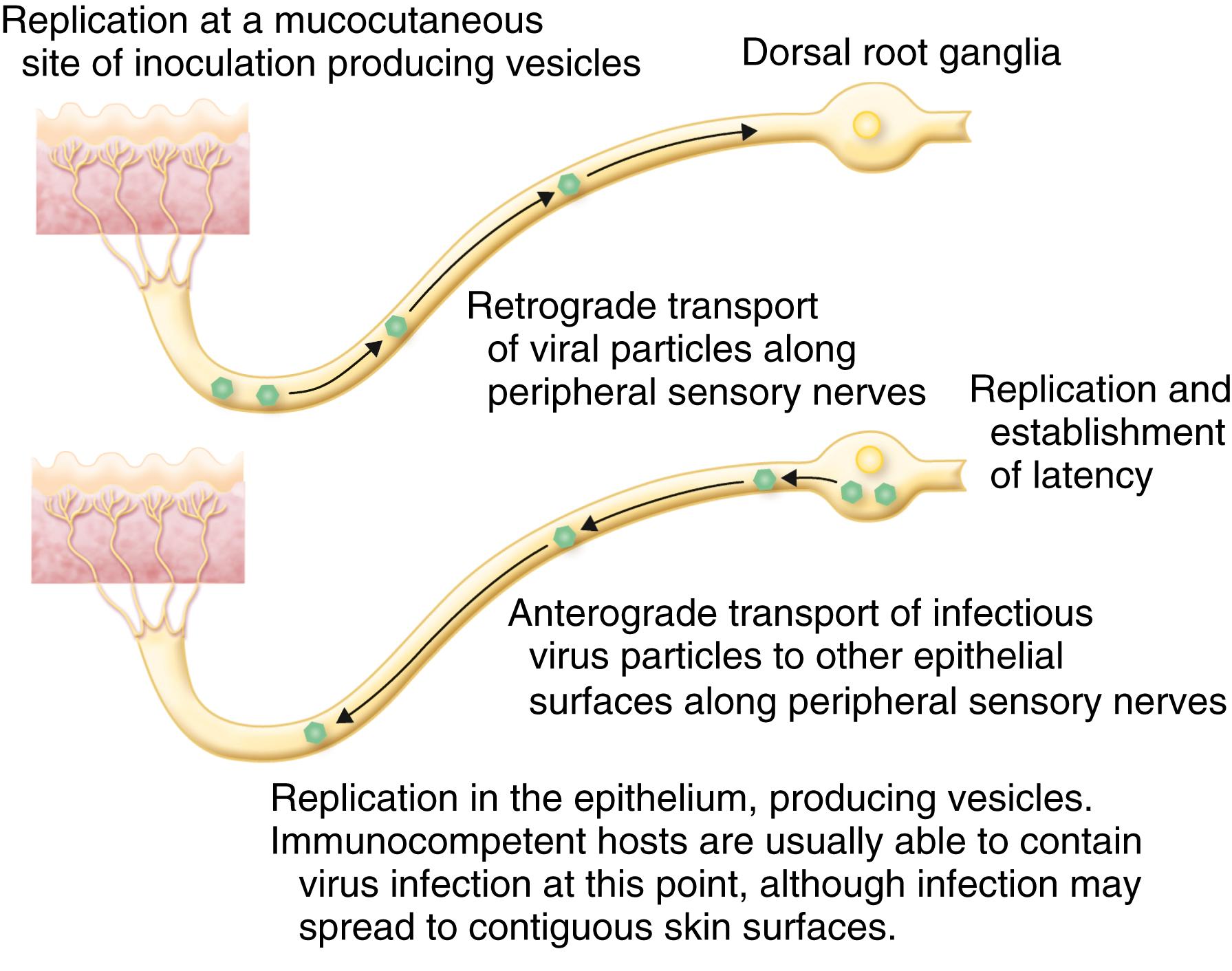 E-FIGURE 345-3, Schematic diagram of primary herpes simplex virus infection.