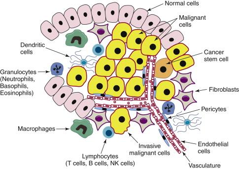 Figure 25-1, Solid tumors are systems within the human system