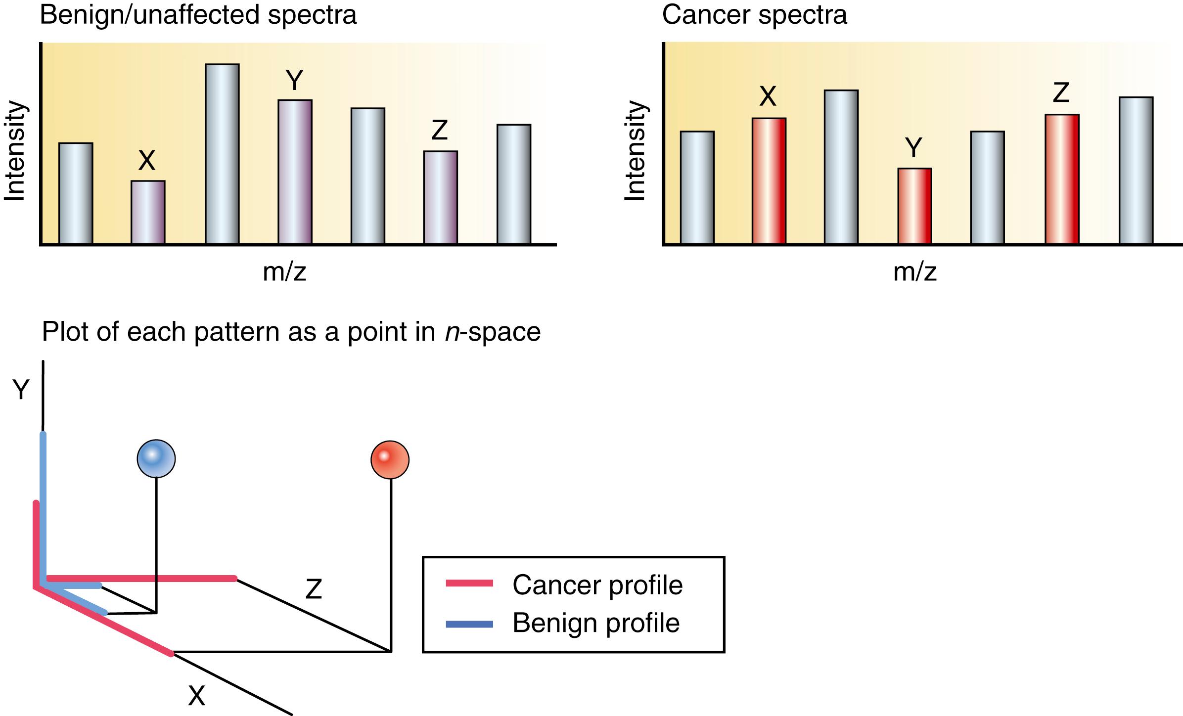 Figure 80.6, Proteomic pattern diagnostics. Pattern analysis identifies m/z ratios with the “most fit” combination of proteins for distinguishing between clinical states of interest.