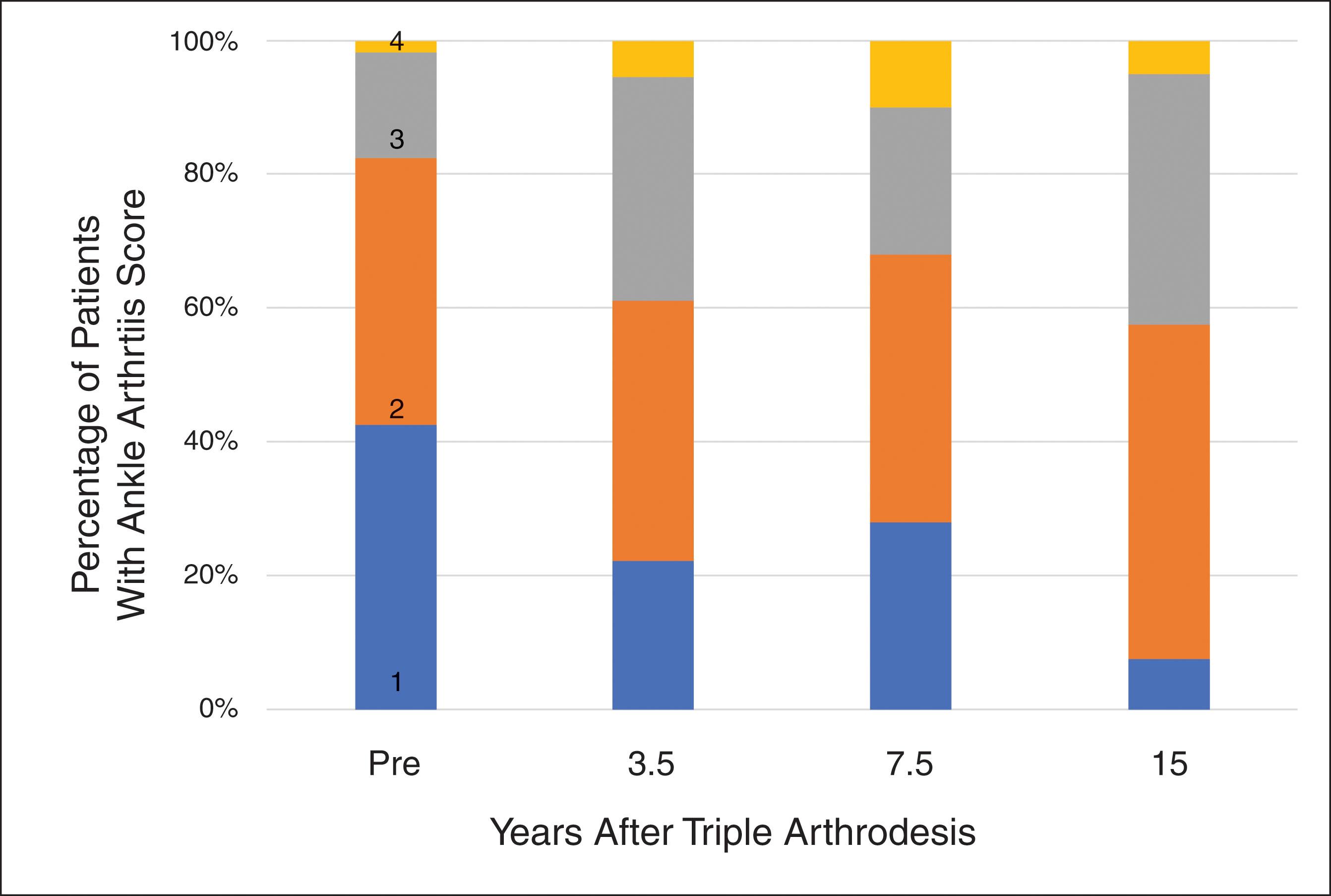 Fig. 25-1, Ankle arthritis before and after triple arthrodesis. The percentage of patients with Kellgren-Lawrence grade 1–4 ankle arthritis is shown before surgery (Pre) and at 3.5, 7.5, and 15 years after triple arthrodesis. The trend for early-stage ankle arthritis to progress to later stage arthritis is shown, though few patients developed end-stage (grade 4) ankle arthritis. Numerals on the first column represent Kellgren-Lawrence grade, which can be followed by color in each subsequent column. 21 22 23