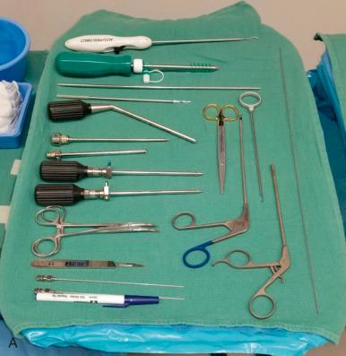 Fig. 79.2, (A) Mayo stand near the surgeon (Mayo #1 in Fig. 79.1 ) contains (from top to bottom on left side of stand) suture passing device (Accu-Pass Direct, Smith & Nephew, Andover, MA), 8.5 mm clear cannula, switching stick, beaver blade, slotted cannula, 5.0 mm obturator, 5.0 mm cannula, 5.0 mm cannulated obturator in cannula (blue) , 4.5 mm cannulated obturator in cannula (green) , two hemostats, #11 blade scalpel, two 17-gauge spinal needles, marker; and on right side of stand (from left to right) suture-cutting scissors, looped suture retriever, knot-pusher, arthroscopic suture cutter, and nitinol wire. (B) Mayo stand across table from surgeon (Mayo #2 in Fig. 79.1 ) contains (clockwise, from top) arthroscopic 4.5 mm curved shaver, arthroscopic fluid tubing, 70-degree arthroscope, radiofrequency wand, and moist lap sponge in fluid bowl. (C) Scrub technician back table contains sterile gowns and glove, two dedicated hip arthroscopy instrument sets, battery power pack for drilling (for suture anchor placement), “shower curtain” sterile adhesive hip arthroscopy drape, nonabsorbable 3-0 suture (for portal incision closure), and sterile towels.