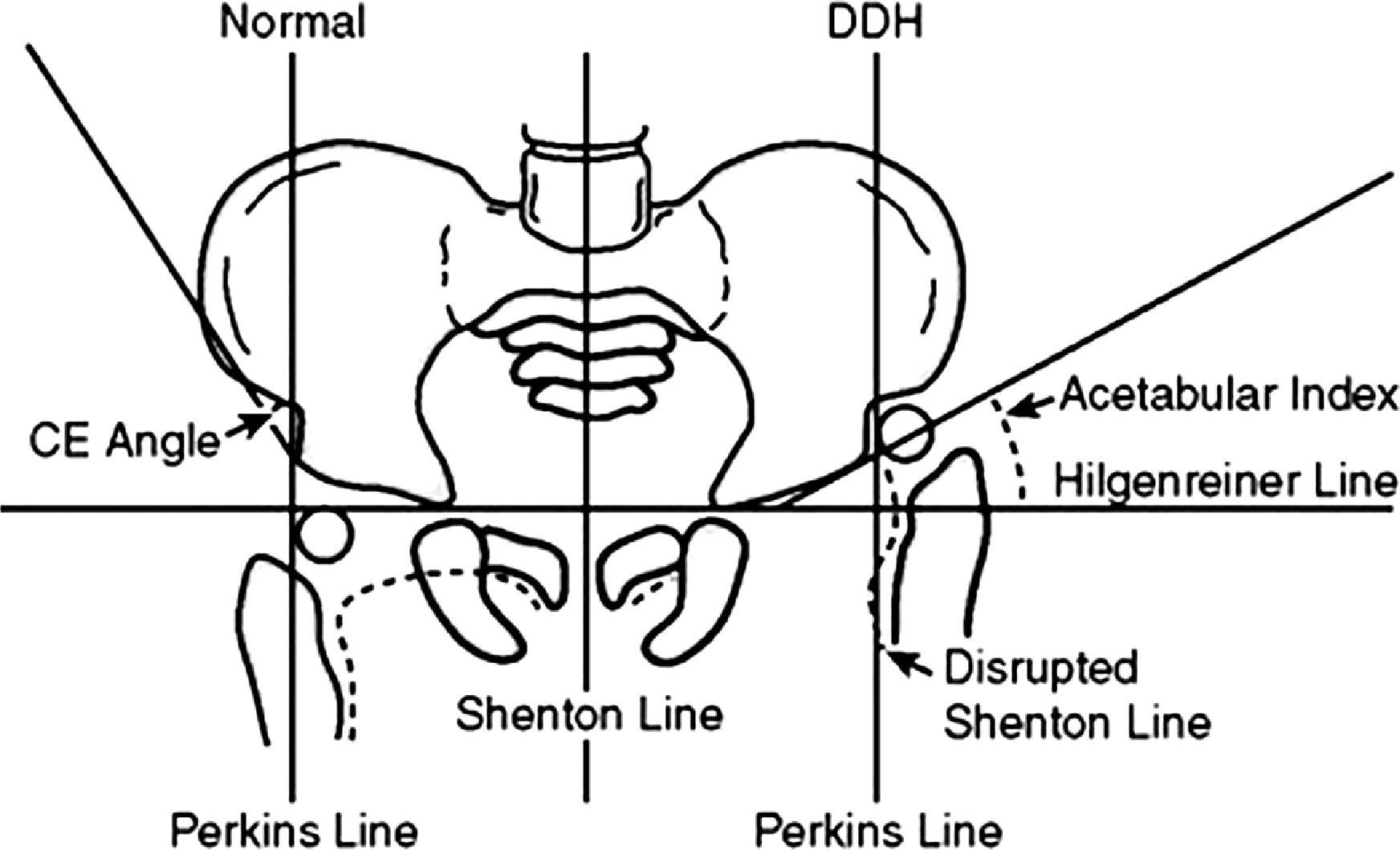 Fig. 73.4, Diagram of Radiographic Measurements .