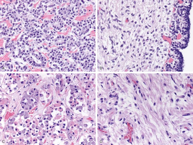 Fig. 20.4, Normal pituitary gland from fetal (A, B) (23 weeks gestation) and adult (C, D) time periods. Note the rich vascularity of the anterior gland, especially in fetal time periods (A), and the acinar pattern and assortment of cell types in anterior gland better appreciated in adult (C) than fetal (A) gland, as well as the fibrillary features of posterior gland (B, D) (with intermediate lobe epithelium seen at right on B).