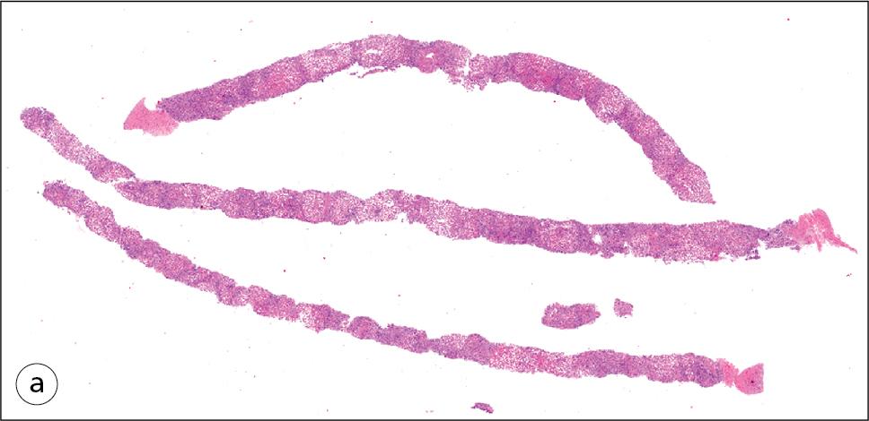 Fig. 1.2, Kidney.