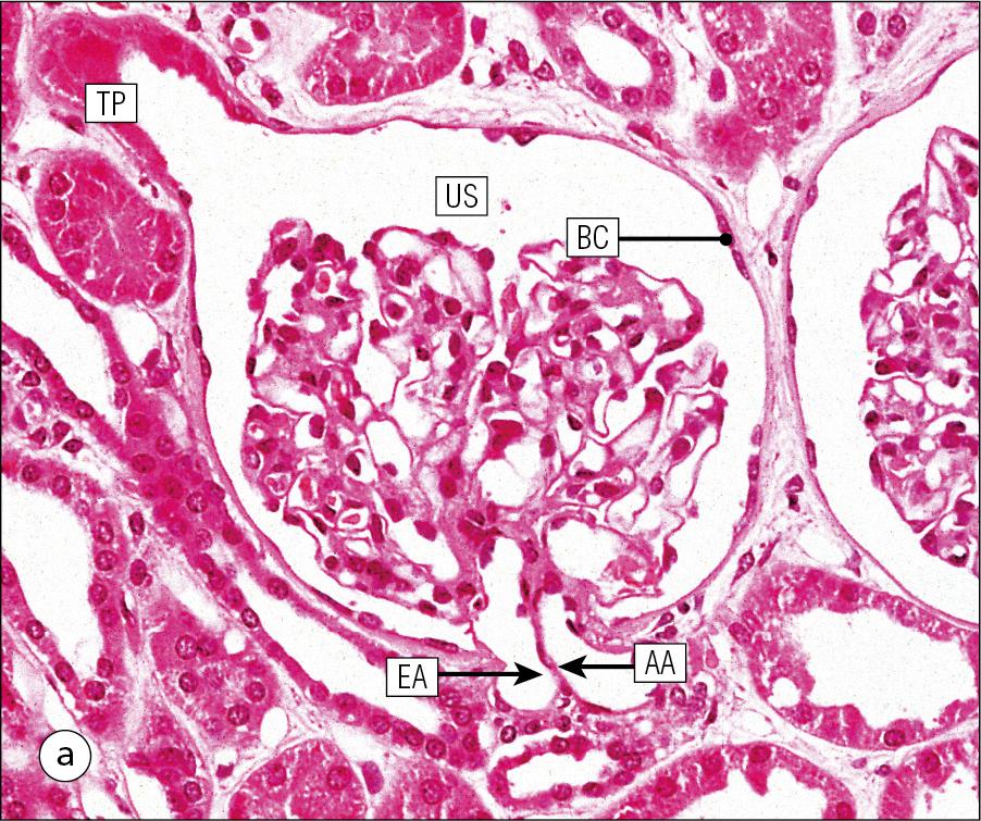 Fig. 1.5, Comparison of microscopic techniques using a kidney glomerulus visualized by different microscopic methods: (a) wax histology, (b) resin histology, (c) scanning electron microscopy, (d) transmission electron microscopy and (e) confocal microscopy. Different methods show different levels of detail. In the wax section (a) can be seen arterioles (EA and AA), Bowman’s capsule lined by epithelium (BC), the space where urine flows (US) and the tubule down which it leaves the glomerulus (TP). The resin section (b) shows more detail with red blood cells (RBC) seen in glomerular capillaries and details of mesangial cells (M) not easily seen in the wax section. The scanning EM image (c) shows the three-dimensional shape of glomeruli (G) and tubules (T) in the renal cortex but not much fine detail. A transmission EM (d) shows very high resolution and additional detail revealing the fine structure of podocytes (EP), which have foot processes (P1, P2) lying on a basement membrane (GBM), with very thin endothelial cells (EnC) on the other side. The confocal image (e) has been stained by immunohistochemistry and shows basement membrane components in green with cell nuclei in purple.